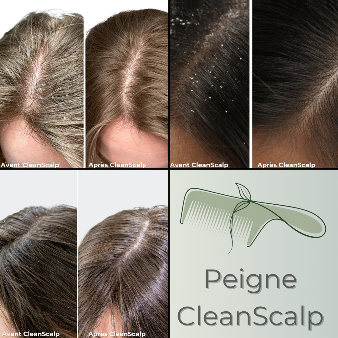 Peigne CleanScalp